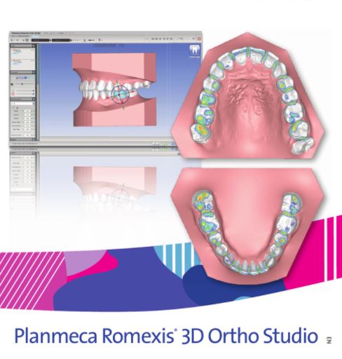 Программное обеспечение Planmeca Romexis 3D Ortho Studio Advanced - Planmeca