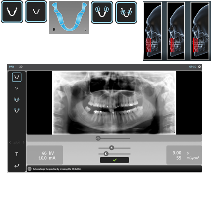 Ортопантонограф панорамный рентген 3D KAVO OP (5 x 5, 6 x 9 и 9 x11 см). - Instrumentarium Dental, PaloDEx Group Oy