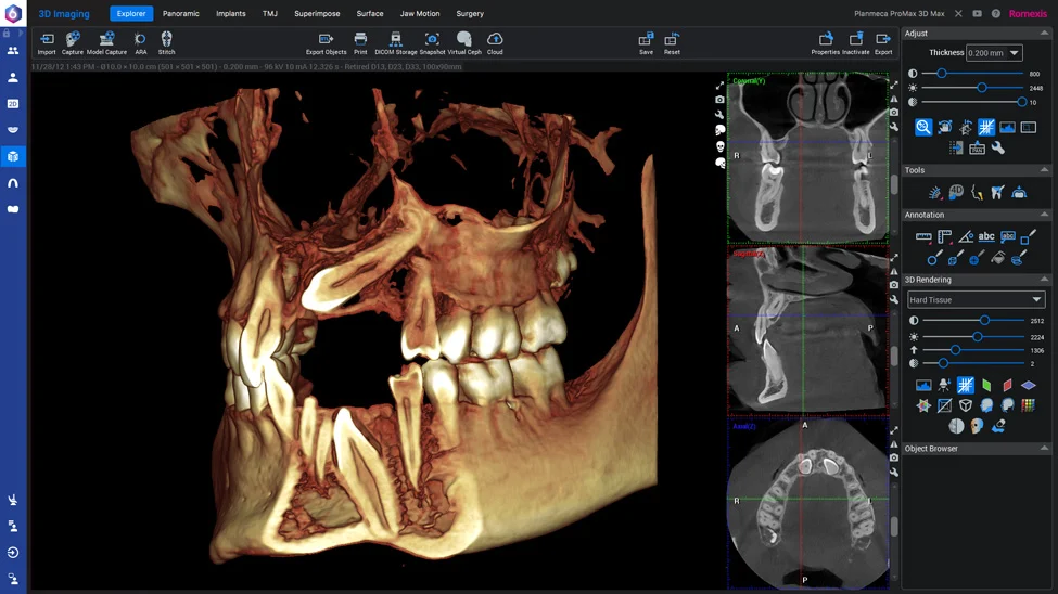 Программное обеспечение Planmeca Romexis 3D imaging  - Planmeca